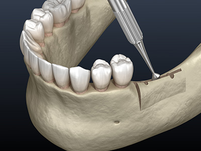 A R Periodontics, PC